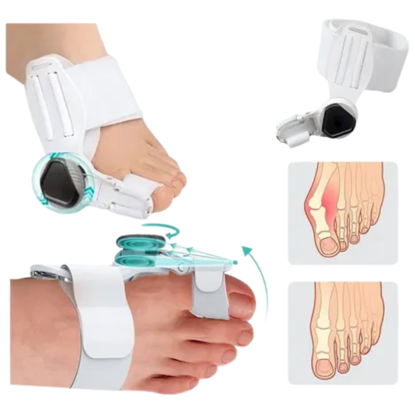 Corrector de Juanetes Pro: Férula Ajustable con Alivio Instantáneo