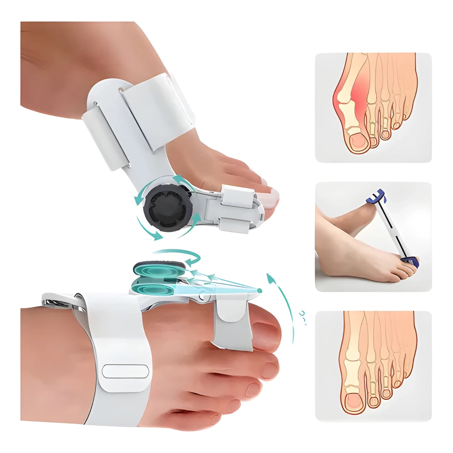 Corrector de Juanetes Pro: Férula Ajustable con Alivio Instantáneo